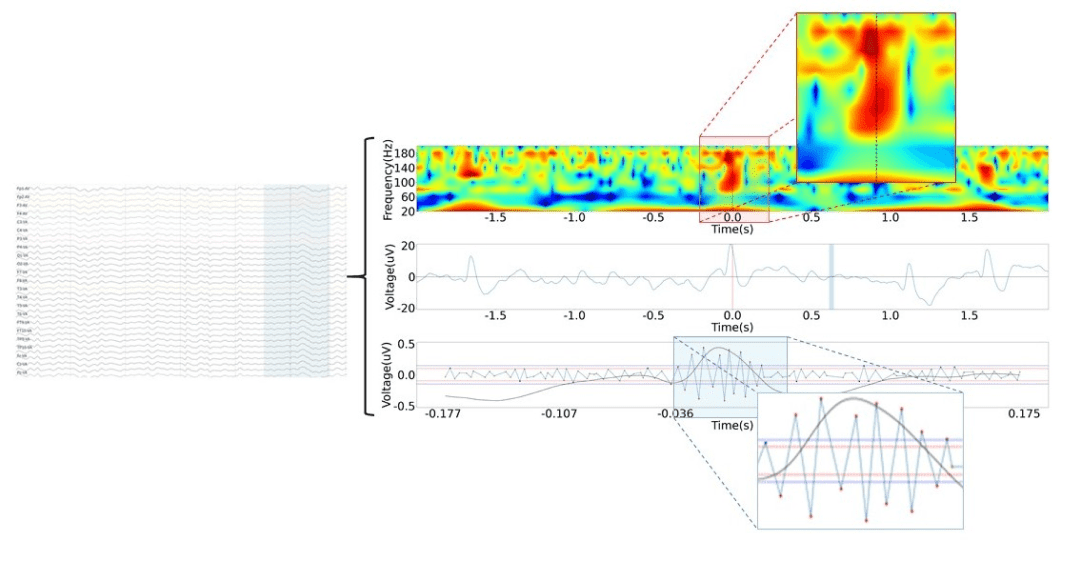 Time-Frequency Analysis & High-Frequency Oscillations